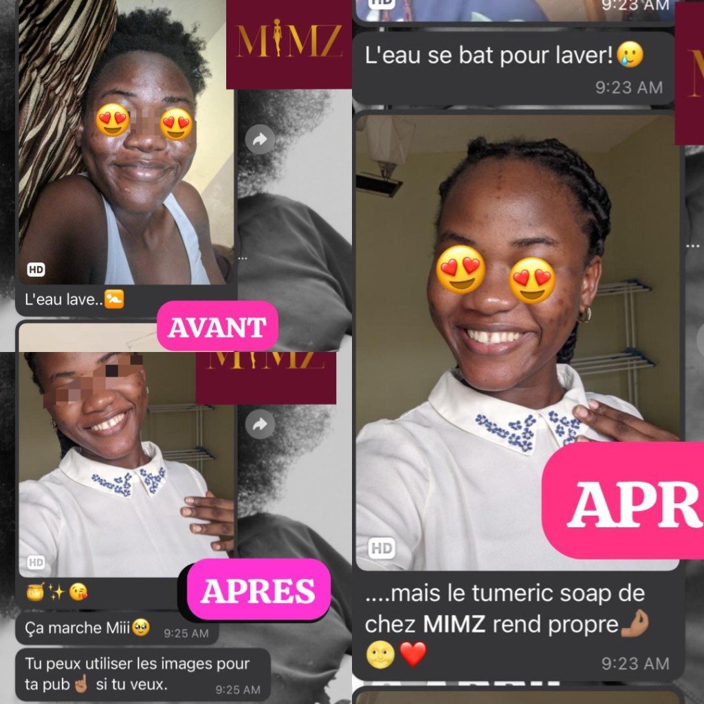 Before and After – Skin Transformation with MIMZ Tumeric Soap